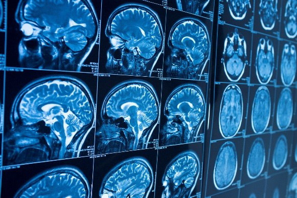 Neurosurgery