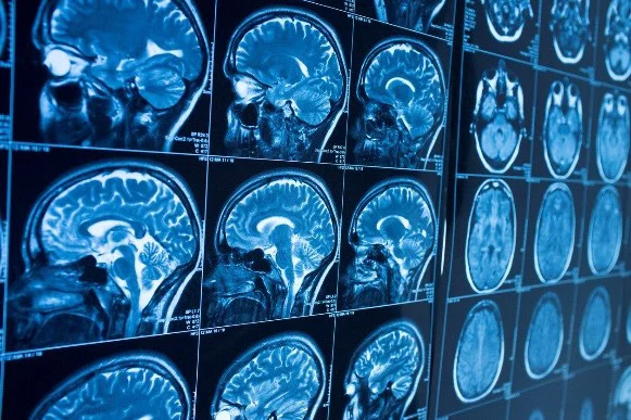 Neurosurgery